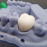 Nhựa Resin Răng Tạm JamgHe Temporary Crown & Bridge Resin - Image 3